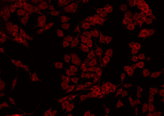 CPB2 / TAFI Antibody - Staining HepG2 cells by IF/ICC. The samples were fixed with PFA and permeabilized in 0.1% Triton X-100, then blocked in 10% serum for 45 min at 25°C. The primary antibody was diluted at 1:200 and incubated with the sample for 1 hour at 37°C. An Alexa Fluor 594 conjugated goat anti-rabbit IgG (H+L) Ab, diluted at 1/600, was used as the secondary antibody.