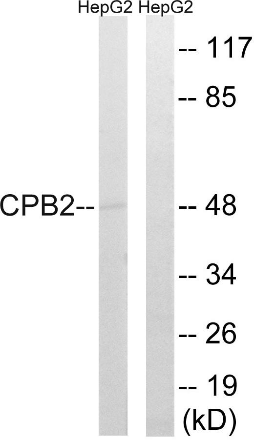 CPB2 / TAFI Antibody - Western blot analysis of extracts from HepG2 cells, using CPB2 antibody.