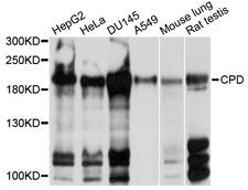 CPD Antibody - Western blot analysis of extracts of various cell lines, using CPD antibody at 1:1000 dilution. The secondary antibody used was an HRP Goat Anti-Rabbit IgG (H+L) at 1:10000 dilution. Lysates were loaded 25ug per lane and 3% nonfat dry milk in TBST was used for blocking. An ECL Kit was used for detection and the exposure time was 10s.