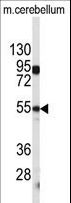 CPE / Carboxypeptidase E Antibody - Western blot of CPE antibody in mouse cerebellum tissue lysates (35 ug/lane). CPE (arrow) was detected using the purified antibody.
