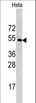 CPE / Carboxypeptidase E Antibody - Western blot of CPE antibody in HeLa cell line lysates (35 ug/lane). CPE (arrow) was detected using the purified antibody.