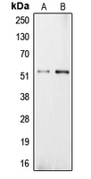 CPE / Carboxypeptidase E Antibody - Western blot analysis of Carboxypeptidase E expression in NIH3T3 (A); PC12 (B) whole cell lysates.