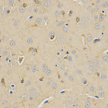 CPE / Carboxypeptidase E Antibody - Immunohistochemistry of paraffin-embedded rat brain tissue.