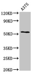 CPE / Carboxypeptidase E Antibody - Positive Western Blot detected in A375 whole cell lysate. All lanes: CPE antibody at 2.7 µg/ml Secondary Goat polyclonal to rabbit IgG at 1/50000 dilution. Predicted band size: 54, 50 KDa. Observed band size: 54 KDa