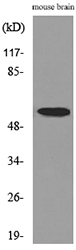CPE / Carboxypeptidase E Antibody - Western blot analysis of lysate from mouse brain cells, using CPE Antibody.