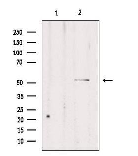 CPE / Carboxypeptidase E Antibody - Western blot analysis of extracts of rat brain tissue using CPE antibody. Lane 1 was treated with the blocking peptide.