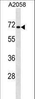 CPEB1 / CPEB Antibody - CPEB1 Antibody western blot of A2058 cell line lysates (35 ug/lane). The CPEB1 antibody detected the CPEB1 protein (arrow).