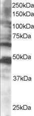 CPEB1 / CPEB Antibody - Antibody staining (0.5 ug/ml) of human brain lysate (RIPA buffer, 35 ug total protein per lane). Primary incubated for 1 hour. Detected by Western blot of chemiluminescence.