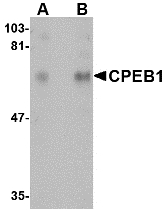 CPEB1 / CPEB Antibody - Western blot of CPEB1 in rat brain tissue lysate with CPEB1 antibody at (A) 1 and (B) 2 ug/ml.
