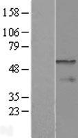CPEB1 / CPEB Protein - Western validation with an anti-DDK antibody * L: Control HEK293 lysate R: Over-expression lysate