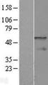 CPEB1 / CPEB Protein - Western validation with an anti-DDK antibody * L: Control HEK293 lysate R: Over-expression lysate