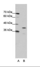 CPEB2 Antibody - A: Marker, B: Jurkat Cell Lysate.  This image was taken for the unconjugated form of this product. Other forms have not been tested.