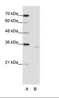 CPEB2 Antibody - B: Jurkat Cell Lysate.  This image was taken for the unconjugated form of this product. Other forms have not been tested.