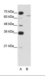 CPEB2 Antibody - A: Marker, B: Jurkat Cell Lysate.  This image was taken for the unconjugated form of this product. Other forms have not been tested.