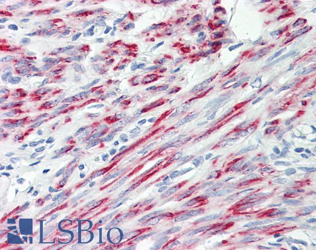CPEB2 Antibody - Anti-CPEB2 antibody IHC of human uterus, myometrium. Immunohistochemistry of formalin-fixed, paraffin-embedded tissue after heat-induced antigen retrieval. Antibody dilution 5-10 ug/ml. This image was taken for the unconjugated form of this product. Other forms have not been tested.
