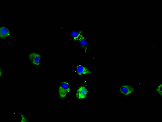 CPEB2 Antibody - Immunofluorescent analysis of Hela cells using CPEB2 Antibody at a dilution of 1:100 and Alexa Fluor 488-congugated AffiniPure Goat Anti-Rabbit IgG(H+L)