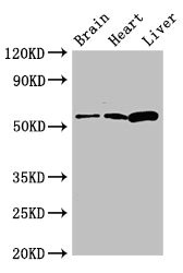 CPEB2 Antibody - Western Blot Positive WB detected in: Mouse brain tissue, Rat heart tissue, Rat liver tissue All lanes: CPEB2 antibody at 2.7µg/ml Secondary Goat polyclonal to rabbit IgG at 1/50000 dilution Predicted band size: 65 kDa Observed band size: 65 kDa