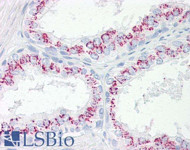 CPEB3 Antibody - Anti-CPEB3 antibody IHC of human prostate. Immunohistochemistry of formalin-fixed, paraffin-embedded tissue after heat-induced antigen retrieval. Antibody dilution 5-7.5 ug/ml.  This image was taken for the unconjugated form of this product. Other forms have not been tested.