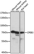 CPEB3 Antibody - Western blot analysis of extracts of various cell lines, using CPEB3 antibody at 1:1000 dilution. The secondary antibody used was an HRP Goat Anti-Rabbit IgG (H+L) at 1:10000 dilution. Lysates were loaded 25ug per lane and 3% nonfat dry milk in TBST was used for blocking. An ECL Kit was used for detection and the exposure time was 3s.