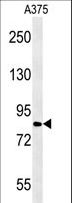 CPEB4 Antibody - CPEB4 Antibody western blot of A375 cell line lysates (15 ug/lane). The CPEB4 antibody detected the CPEB4 protein (arrow).