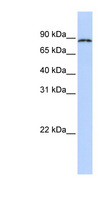 CPEB4 Antibody - CPEB4 antibody Western blot of Fetal Lung lysate. This image was taken for the unconjugated form of this product. Other forms have not been tested.