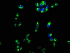 CPEB4 Antibody - Immunofluorescence staining of Hela cells with CPEB4 Antibody at 1:133, counter-stained with DAPI. The cells were fixed in 4% formaldehyde, permeabilized using 0.2% Triton X-100 and blocked in 10% normal Goat Serum. The cells were then incubated with the antibody overnight at 4°C. The secondary antibody was Alexa Fluor 488-congugated AffiniPure Goat Anti-Rabbit IgG(H+L).