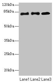 CPEB4 Antibody - Western blot All lanes: CPEB4 antibody at 2µg/ml Lane 1: Hela whole cell lysate Lane 2: 293T whole cell lysate Lane 3: U87 whole cell lysate Secondary Goat polyclonal to rabbit IgG at 1/10000 dilution Predicted band size: 81, 79, 37 kDa Observed band size: 81 kDa