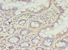 CPED1 Antibody - Immunohistochemistry of paraffin-embedded human small intestine tissue using antibody at dilution of 1:100.