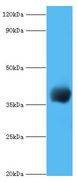 cpg2 / Carboxypeptidase G2 Antibody - western blot All lanes: Carboxypeptidase G2 antibody at 2 ug/ml+recombinant Carboxypeptidase G2 protein at 0.5ug. Secondary antibody: Goat polyclonal to rabbit at 1:10000 dilution. Predicted band size: 38 kDa. Observed band size: 38 kDa.  This image was taken for the unconjugated form of this product. Other forms have not been tested.