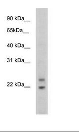 Cphx Antibody - SP2/0 Cell Lysate.  This image was taken for the unconjugated form of this product. Other forms have not been tested.