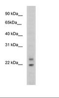 Cphx Antibody - SP2/0 Cell Lysate.  This image was taken for the unconjugated form of this product. Other forms have not been tested.