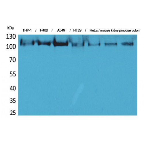 cPLA2 Antibody - Western blot of cPLA2 antibody