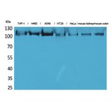 cPLA2 Antibody - Western blot of cPLA2 antibody
