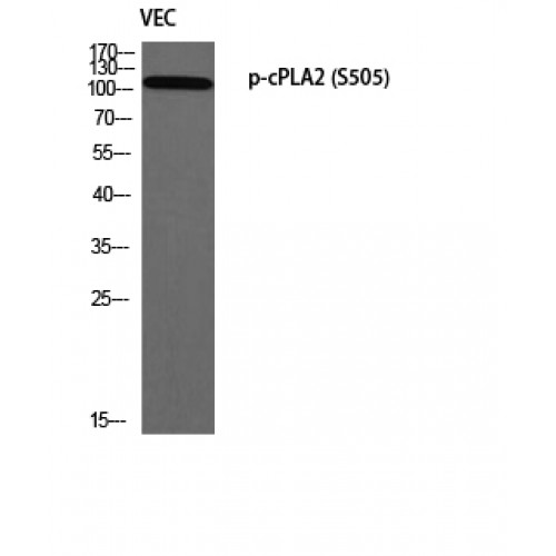 cPLA2 Antibody - Western blot of Phospho-cPLA2 (S505) antibody