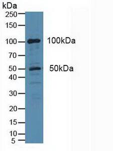 cPLA2 Antibody - Western Blot; Sample: Human Hela Cells.