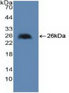 cPLA2 Antibody - Western Blot; Sample: Recombinant cPLA2, Human.