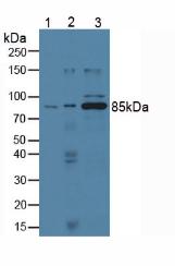 cPLA2 Antibody - Western Blot; Sample: Lane1: Human Lung Tissue; Lane2: Human PC-3 Cells; Lane3: Human Hela Cells.
