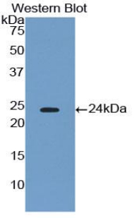 cPLA2 Antibody - Western blot of recombinant cPLA2.  This image was taken for the unconjugated form of this product. Other forms have not been tested.
