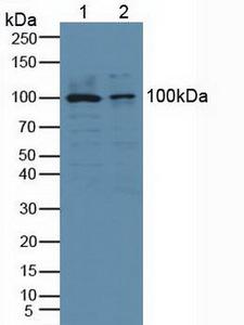 cPLA2 Antibody - Western Blot; Sample: Lane1: Human Hela Cells; Lane2: Human PC-3 Cells.