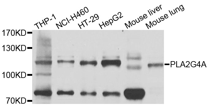 cPLA2 Antibody - Western blot analysis of extracts of various cell lines, using PLA2G4A antibody at 1:1000 dilution. The secondary antibody used was an HRP Goat Anti-Rabbit IgG (H+L) at 1:10000 dilution. Lysates were loaded 25ug per lane and 3% nonfat dry milk in TBST was used for blocking. An ECL Kit was used for detection and the exposure time was 20s.