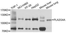 cPLA2 Antibody - Western blot analysis of extracts of various cell lines, using PLA2G4A antibody at 1:1000 dilution. The secondary antibody used was an HRP Goat Anti-Rabbit IgG (H+L) at 1:10000 dilution. Lysates were loaded 25ug per lane and 3% nonfat dry milk in TBST was used for blocking. An ECL Kit was used for detection and the exposure time was 20s.