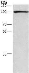 cPLA2 Antibody - Western blot analysis of 293T cell, using PLA2G4A Polyclonal Antibody at dilution of 1:750.