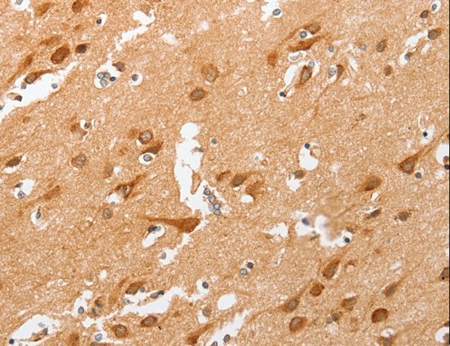 cPLA2 Antibody - Immunohistochemistry of paraffin-embedded Human brain using PLA2G4A Polyclonal Antibody at dilution of 1:50.