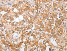 cPLA2 Antibody - Immunohistochemistry of paraffin-embedded Human brain using PLA2G4A Polyclonal Antibody at dilution of 1:40.
