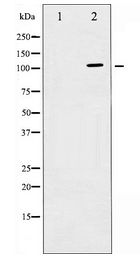 cPLA2 Antibody - Western blot of c-PLA2 expression in TNF-a treated HeLa whole cell lysates,The lane on the left is treated with the antigen-specific peptide.
