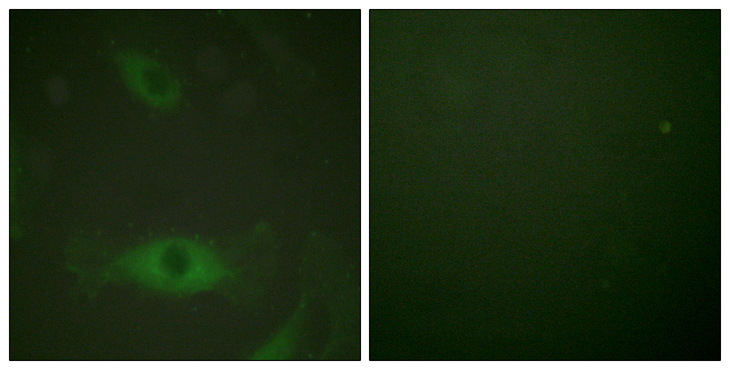 cPLA2 Antibody - Immunofluorescence analysis of HeLa cells treated with TNF-a 20nM 15', using c-PLA2 (Phospho-Ser505) Antibody. The picture on the right is blocked with the phospho peptide.