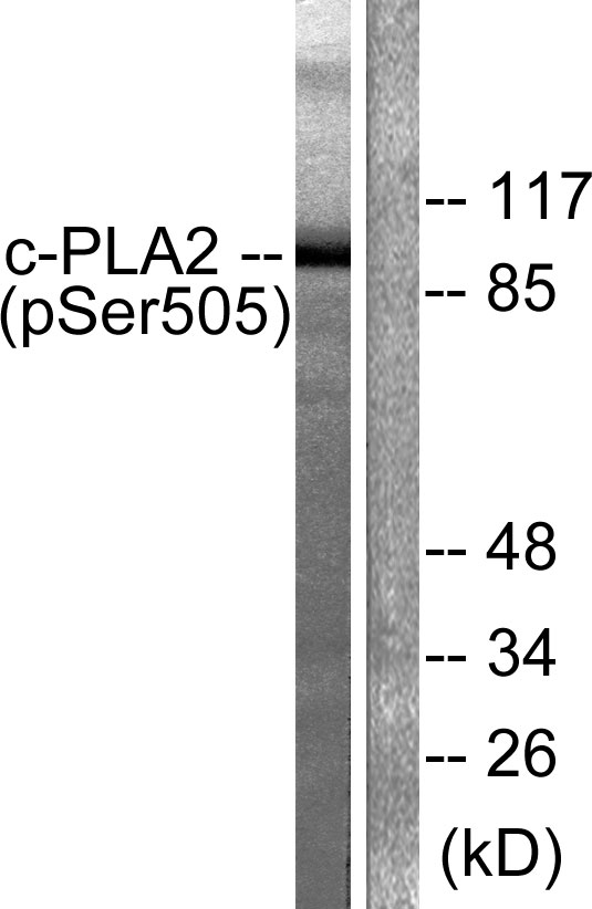 cPLA2 Antibody - Western blot analysis of lysates from HeLa cells treated with TNF-a 20ng/ml 30', using c-PLA2 (Phospho-Ser505) Antibody. The lane on the right is blocked with the phospho peptide.