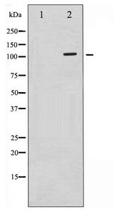 cPLA2 Antibody - Western blot of c-PLA2 phosphorylation expression in TNF-a treated HeLa whole cell lysates,The lane on the left is treated with the antigen-specific peptide.