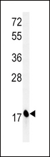 CPLX1 / Complexin 1 Antibody - Western blot of CPLX1 Antibody in mouse brain tissue lysates (35 ug/lane). CPLX1 (arrow) was detected using the purified antibody.