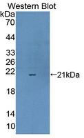 CPLX1 / Complexin 1 Antibody - Western Blot; Sample: Recombinant protein.